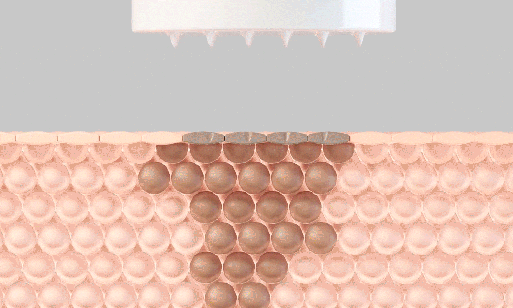 MTS (Microneedle Therapy System) Richtige Anwendung MTS Anwendung 1